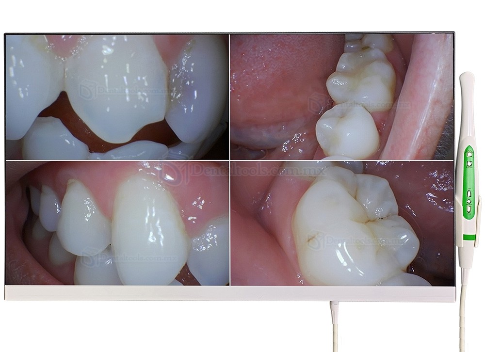 Magenta YF-2400M C&aacute;mara intraoral con monitor de 24
